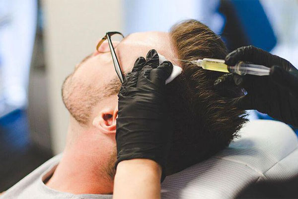 درمانهای جراحی ریزش مو
