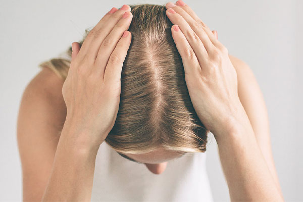 علل ریزش مو ناشی از فرق سر