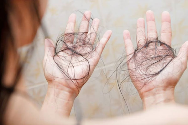 تعریف ریزش مو ژنتیکی چیست